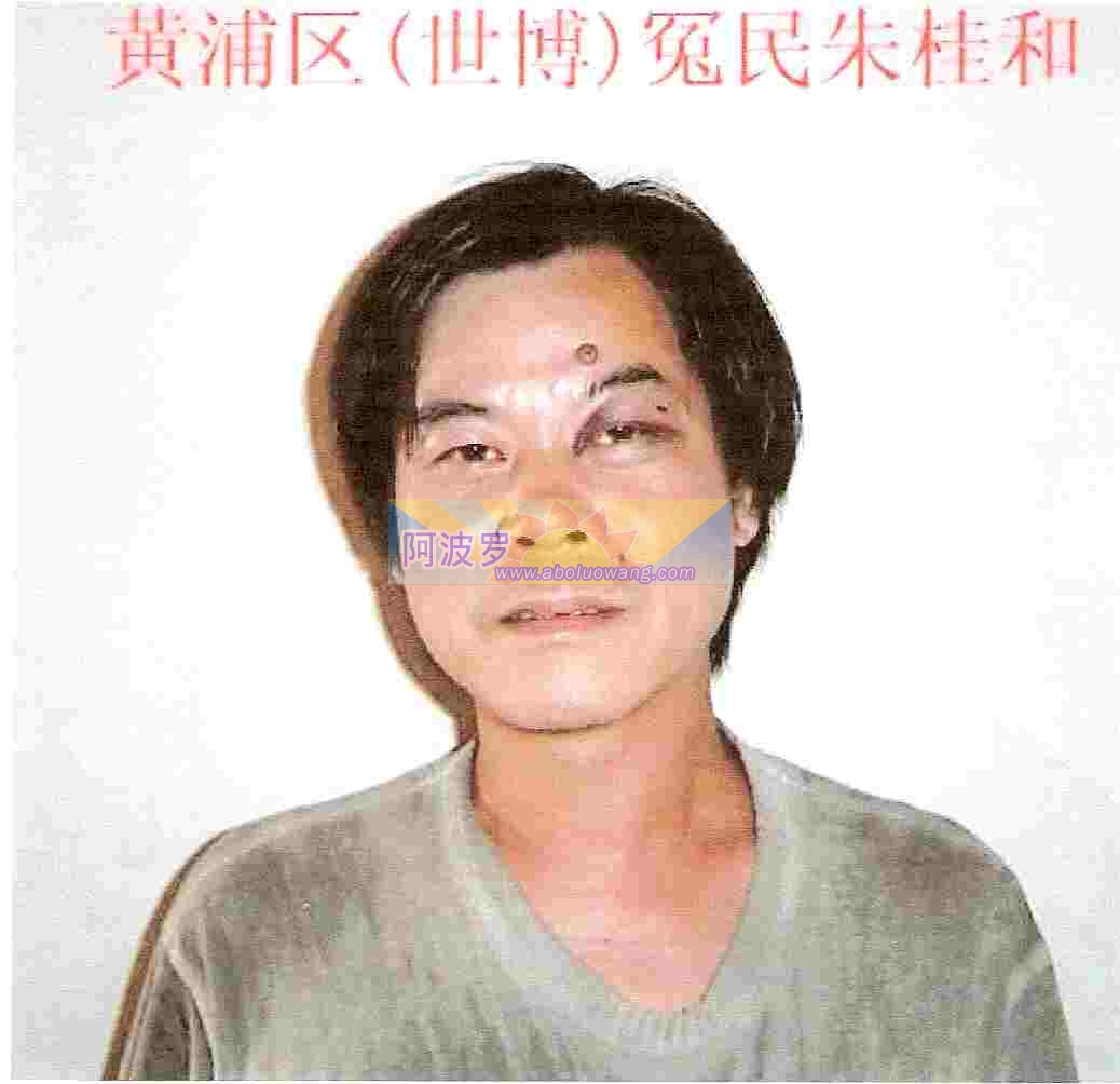 朱桂和07年8月被驻京办暴殴致伤照片.jpg