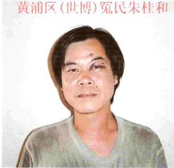 朱桂和07年8月被驻京办暴殴致伤照片.jpg